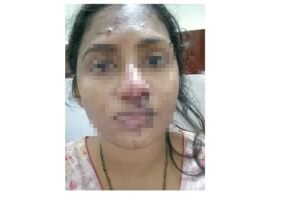 WhatsApp Image 2026-02-04 at 9.33.55 AM