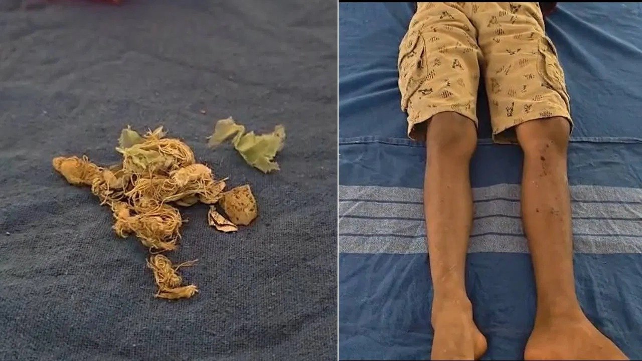 WhatsApp Image 2026-02-20 at 8.33.04 AM